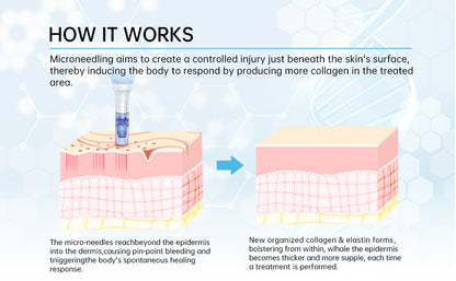 Dr.Pen A6 Professional Microneedling Pen with 12Pcs Cartridges Replacement Needles
