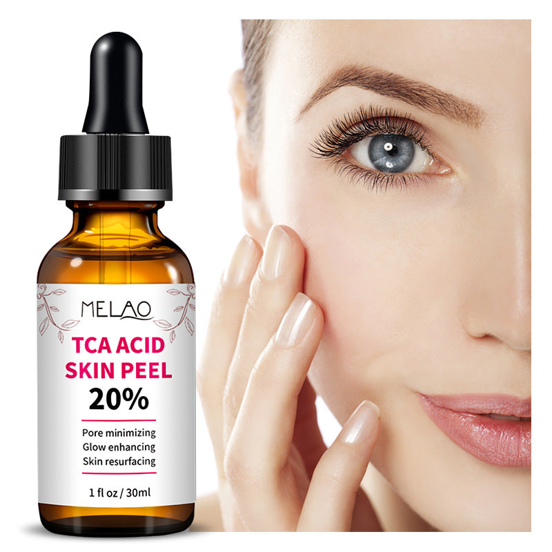 TCA ACID Skin Peel Serum 20%