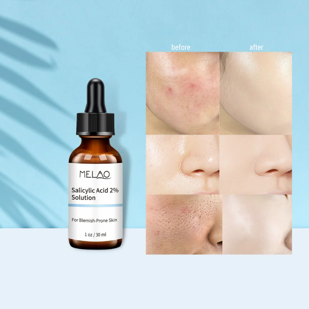 Salicylic Acid Serum 30ml